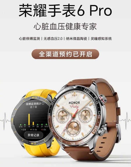 آنر Watch 6 Pro